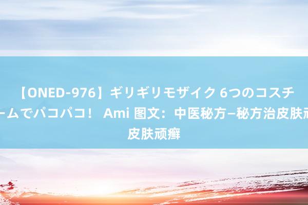 【ONED-976】ギリギリモザイク 6つのコスチュームでパコパコ！ Ami 图文：中医秘方—秘方治皮肤顽癣