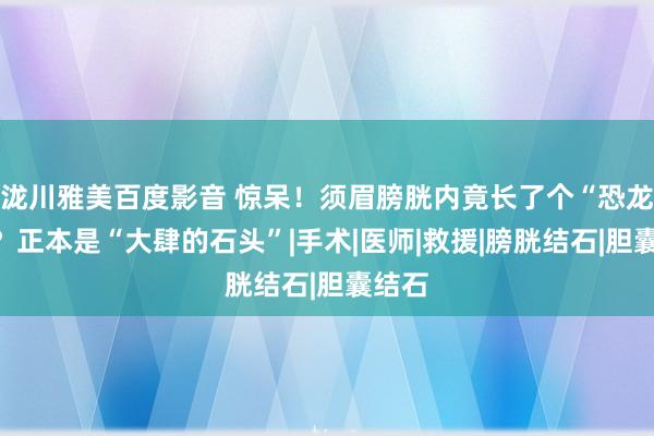 泷川雅美百度影音 惊呆！须眉膀胱内竟长了个“恐龙蛋”？正本是“大肆的石头”|手术|医师|救援|膀胱结石|胆囊结石